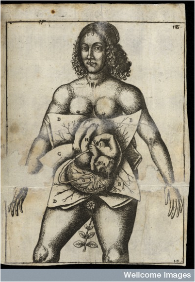 Wellcome Images
